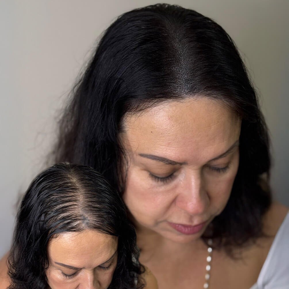 12depoimentos-micropigmentação-André