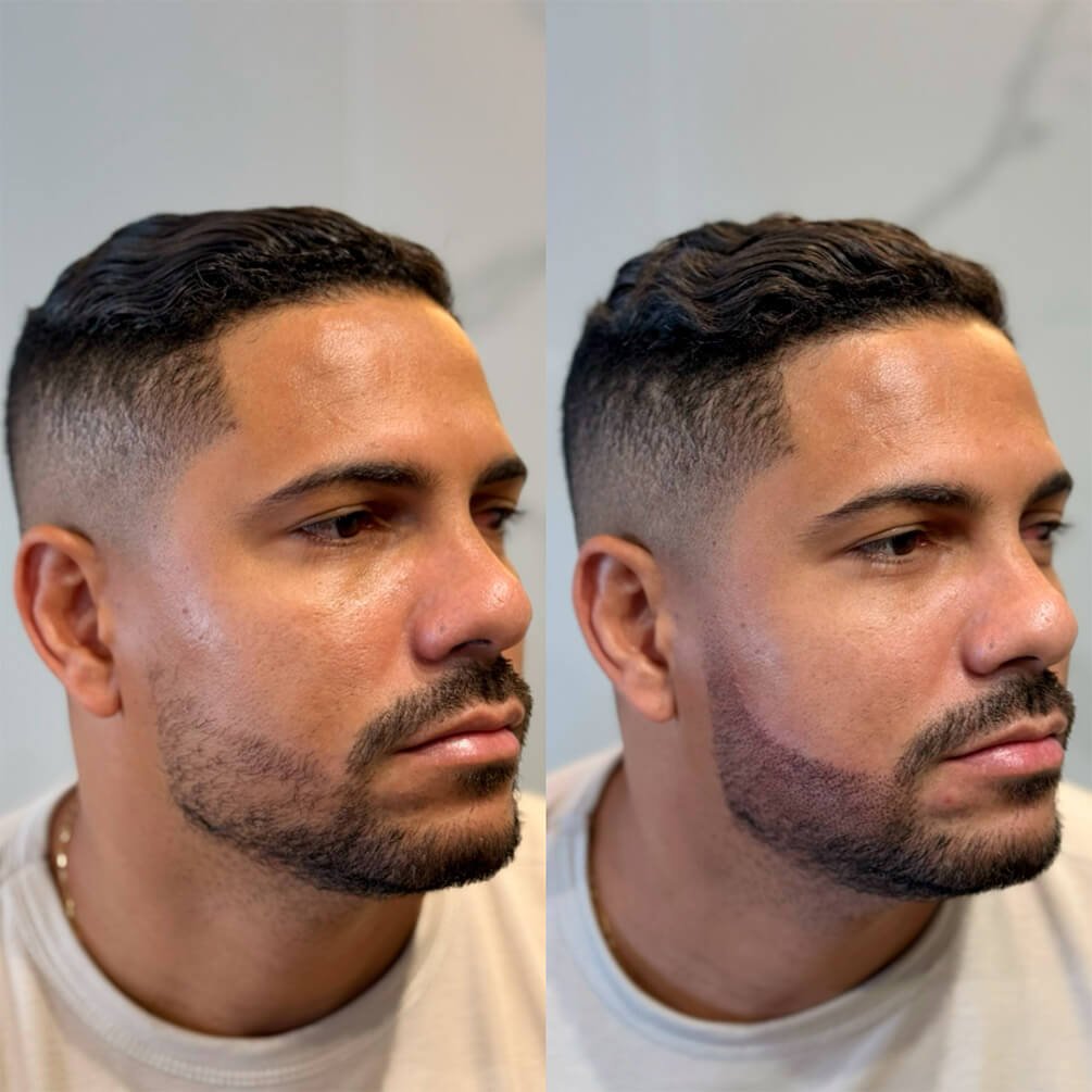 5depoimentos-micropigmentação-André